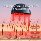 MediLaser Hair 552 Lézeres haj regeneráló, hajnövesztő sisak