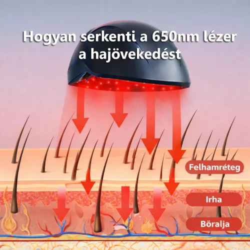 MediLaser Hair 552 Lézeres haj regeneráló, hajnövesztő sisak
