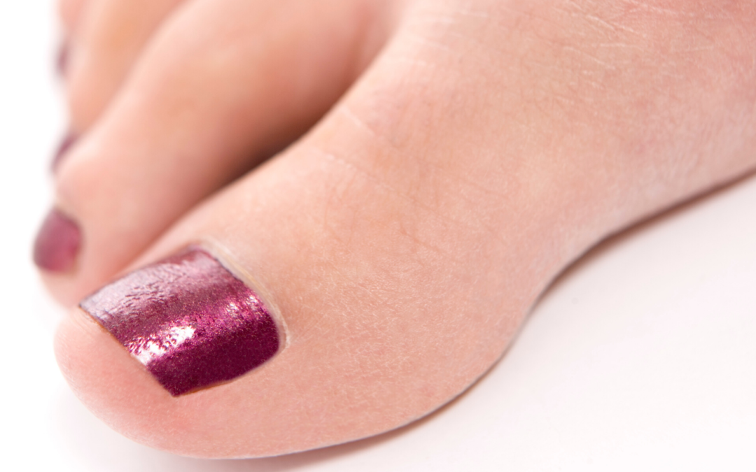HU228525B1 - Antimicotic nail varnish composition - Google Patents