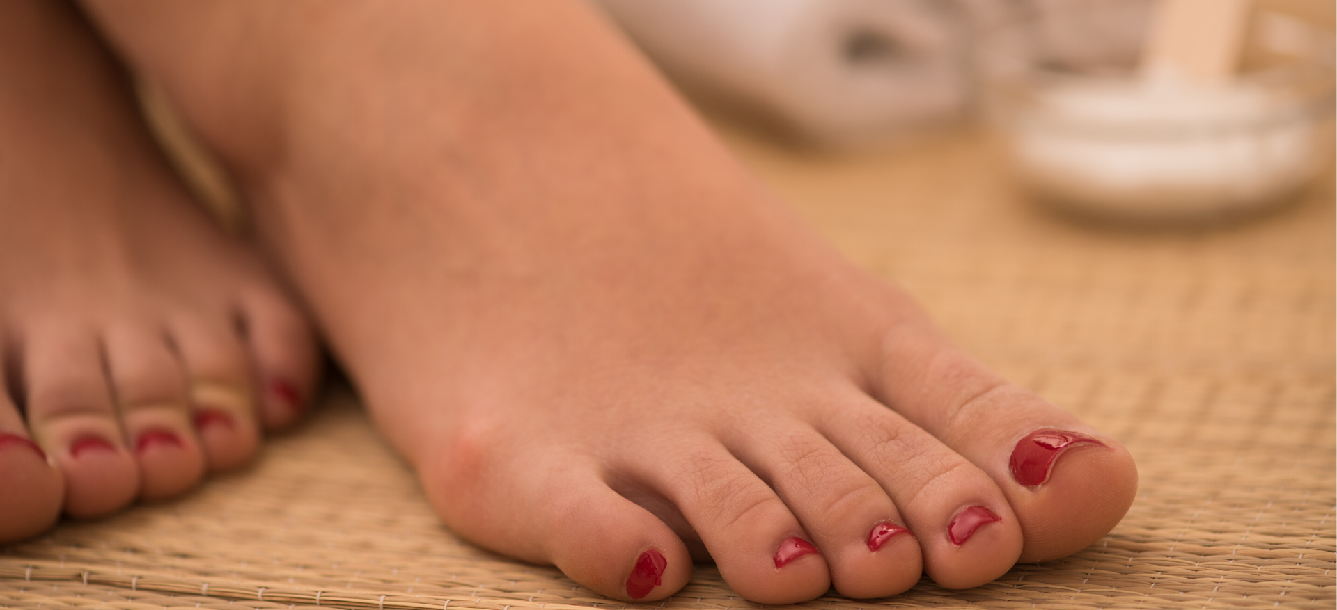 Hogyan lehet megállítani a láb- és körömgombát – Gyogyito Harmonia