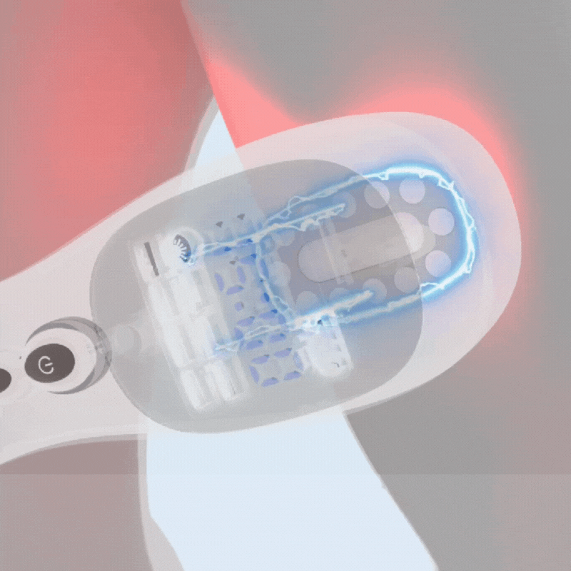 TENS illusztráció – Kép 3