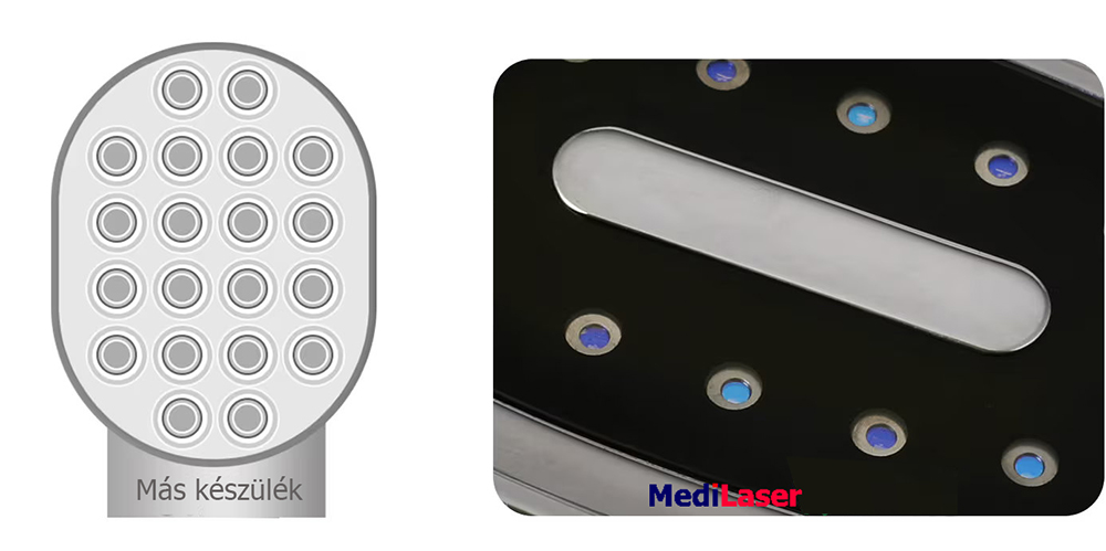 Orvosi videó illusztráció – Kép 5