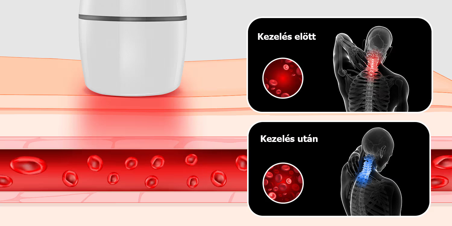 Gyakori kérdések MediLaser Pro készülékről